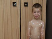 Végre! Június 13-án jön a szúnyogirtás!…