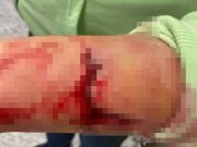 Hajnali horror a szentesi kórházban: folyt a vér, vágott a beteg…