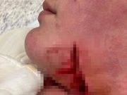 Őrjöngő angol beteg vágta meg a nővéreket a kórházban…